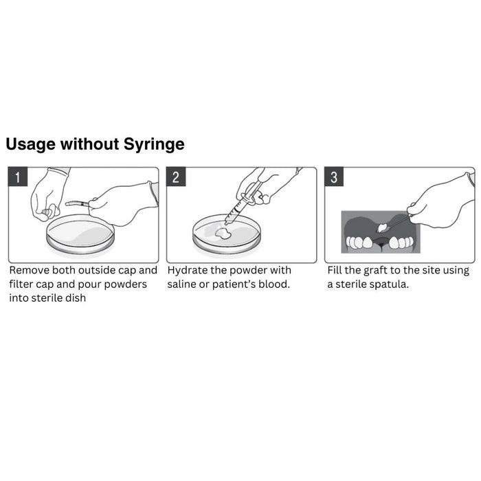 OsseoSeal™ Syringe - Mineralized Cortical Cancellous Bone.25-1.0mm [1.0cc]